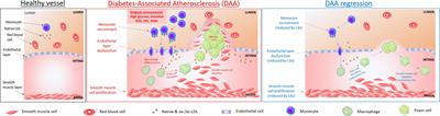 Specialized Pro-resolving Lipid Mediators: Modulation of Diabetes-Associated Cardio-, Reno-, and Retino-Vascular Complications